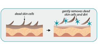 remove dead skin cells