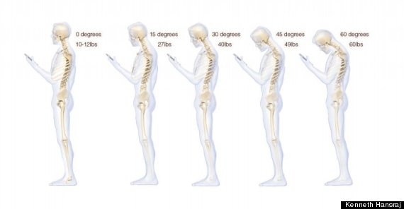 Texting hurts spine