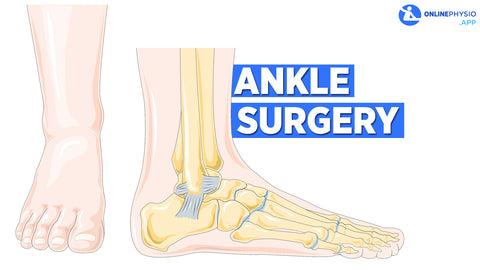 Ankle Arthroscopy