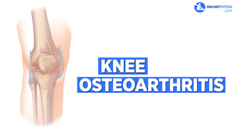 Knee Osteoarthritis