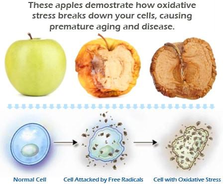 what is oxidative stress 