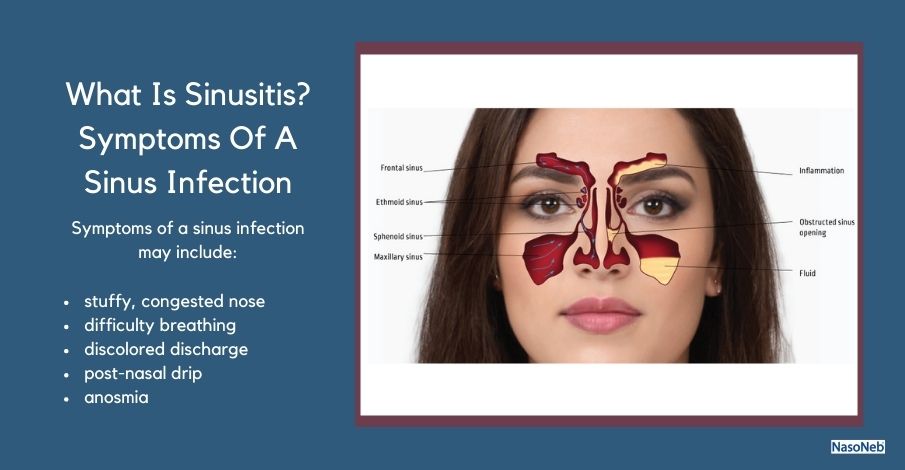 maxillary and ethmoid sinus disease