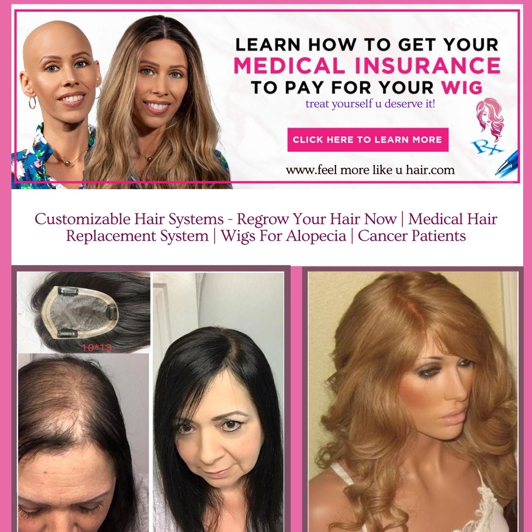 Dme | Cranial Hair Prosthesis | Durable Medical Wig Equipment Provider Hair-loss  Solutions Consultation –  Best Custom Wigs,  Hairpieces, & Hair Replacement Solutions