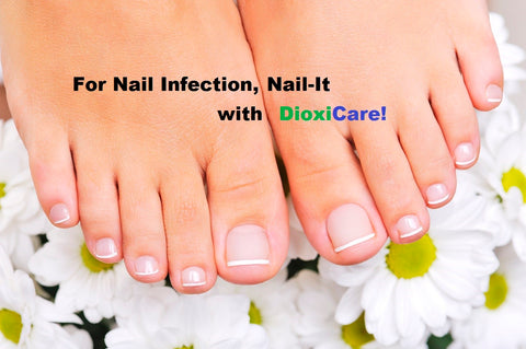 Fungal Nail Infection Cure