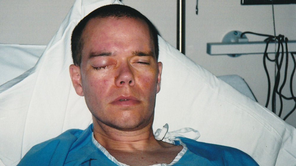 Kevin Robinson in the hospital with eye cancer