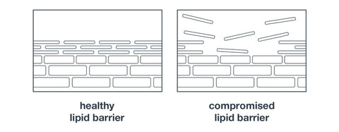 lipid barrier