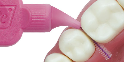 Use of intedental brushes is the most efficient way to remove plaque between the teeth.