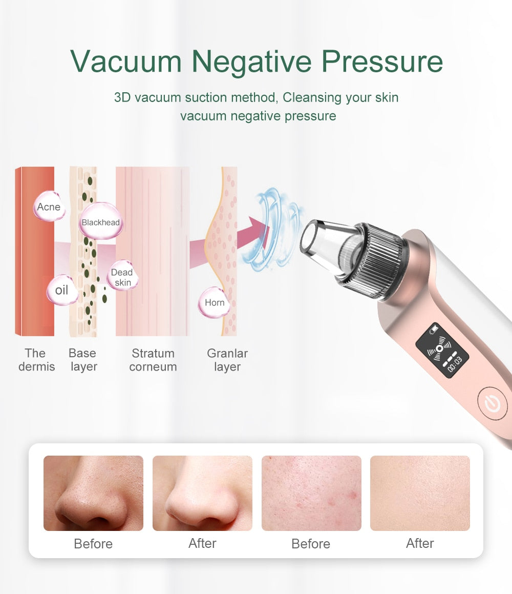 Vacuum Negative Pressure Cleansing your skin.
