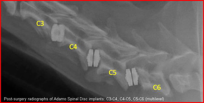 Cervical Disc Replacement in Dogs