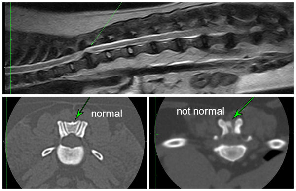 Caudal Articular Process Dysplasia - Pug