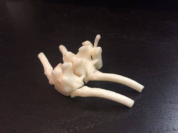 3D Model of Lily's Vertebrae