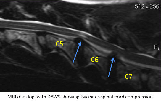 MRI of a dog with DAWs showing spinal cord compression