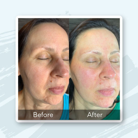 Book a Rejuvenation Duo Treatment in Knoxville, TN