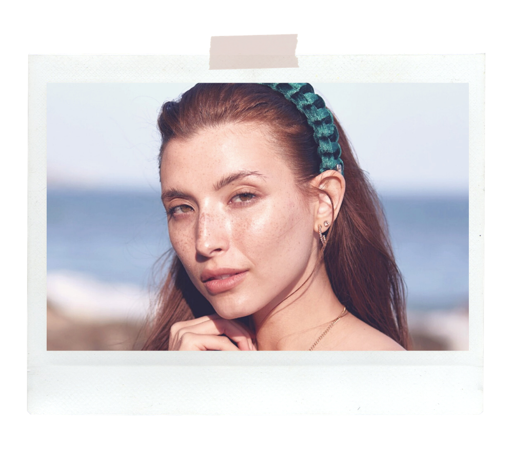 The "It Girl" Has Scars