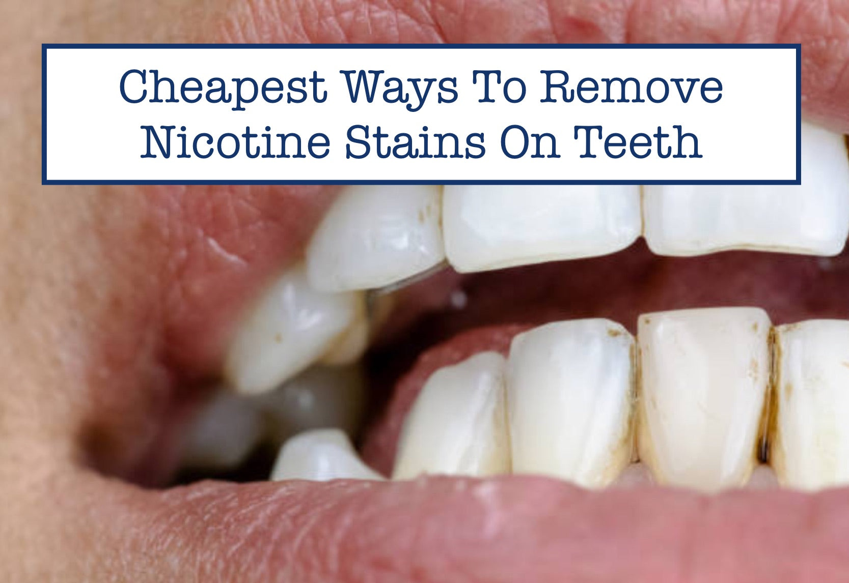 How to Remove Nicotine Stains From Teeth?