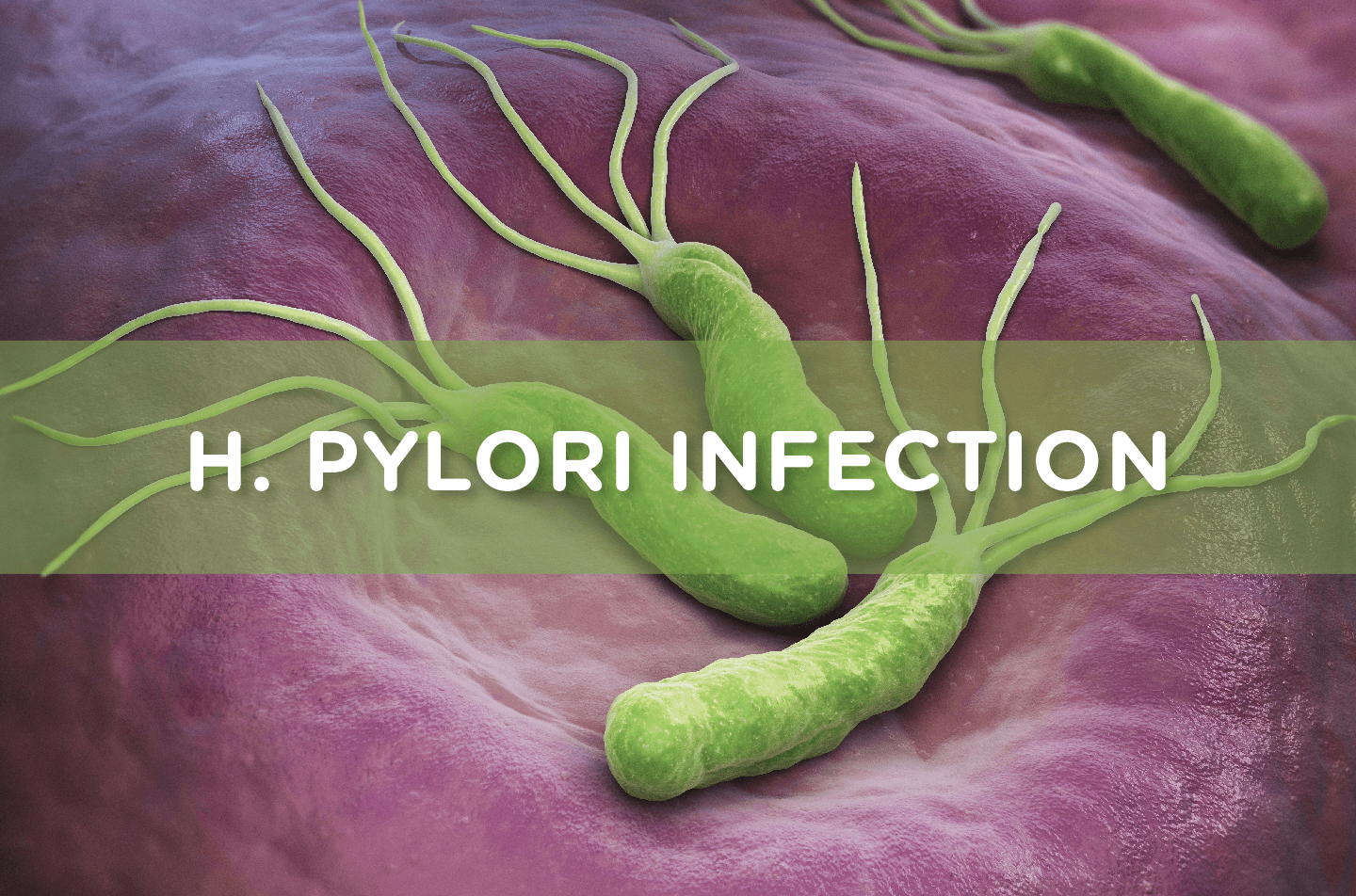 h pylori dysbiosis