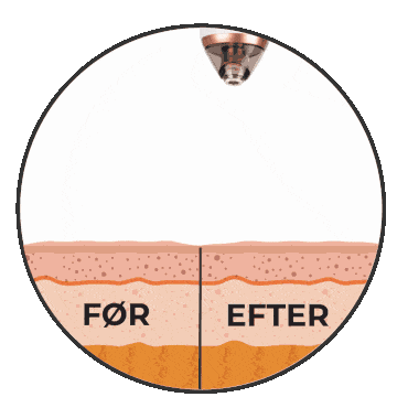 Comforth MicroDerm forbedrer