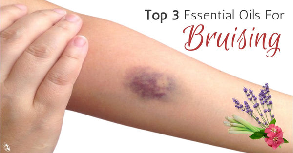 Top 3 Essential Oils For Bruising Organic Aromas