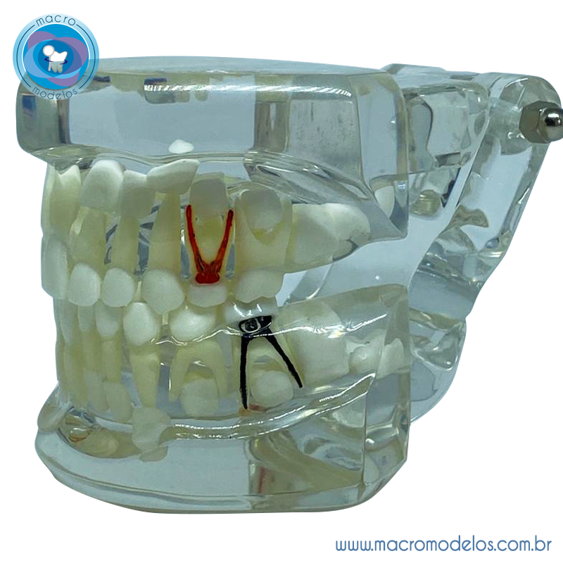 Macro Modelo Dentição Mista - MacroModelos