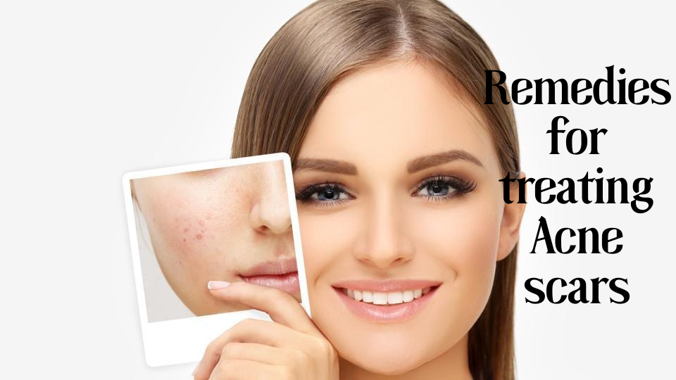 How to get rid of spot scars overnight