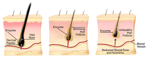 illustration of the stages of hair loss-hair follicle-hair root-www.rdalchemy.com