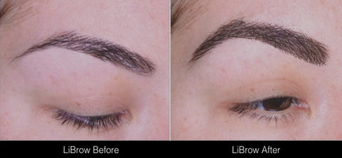 LiBrow - Before and After