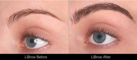 LiBrow Before and After