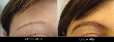 LiBrow Before and After