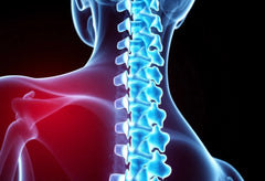 Bli fri från smärta: så hanterar du spinal stenos i nacken effektivt