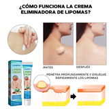 CREMA ELIMINADORA DE LIPOMAS - LIPOMFREE™