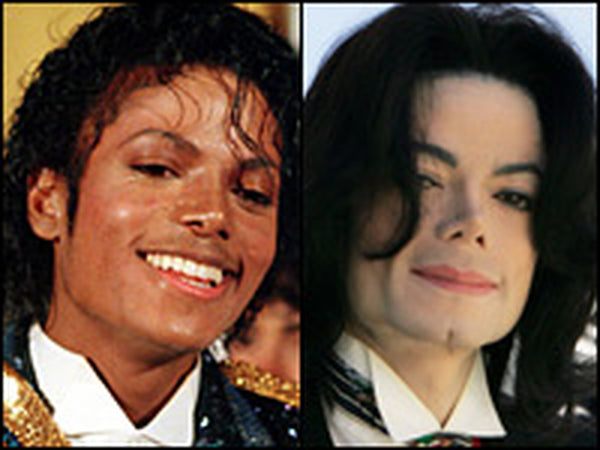 MJ skin bleaching