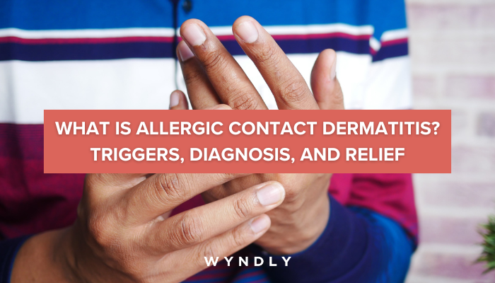 Allergic Contact Dermatitis Symptoms Causes And Treatment 2023n And Wyndly 8148