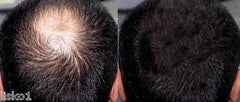 Hair Building Fibers, 6_ 84gms_ Black *NEW SIZE * Hair Loss Concealer