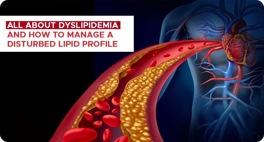 All About Dyslipidemia And How To Manage A Disturbed Lipid Profile Nutrition Daily 5317