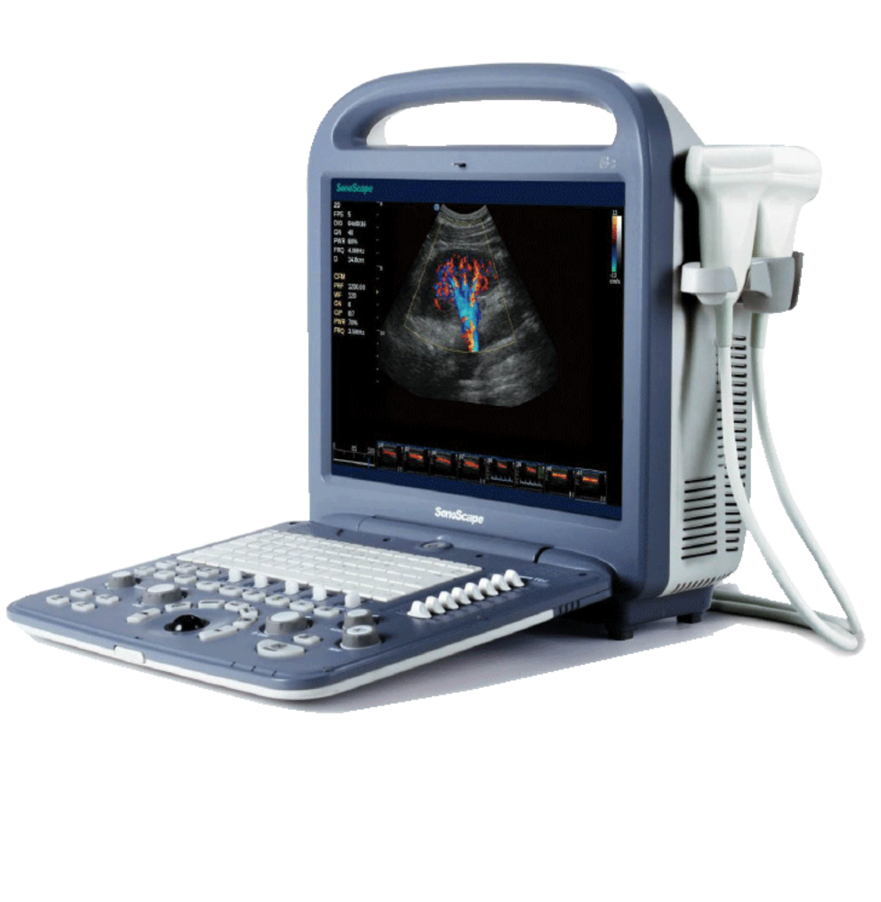 Sonoscape S2v Ultrasound Portable Color Doppler Practical Affordable Veterinary Ultrasounds 