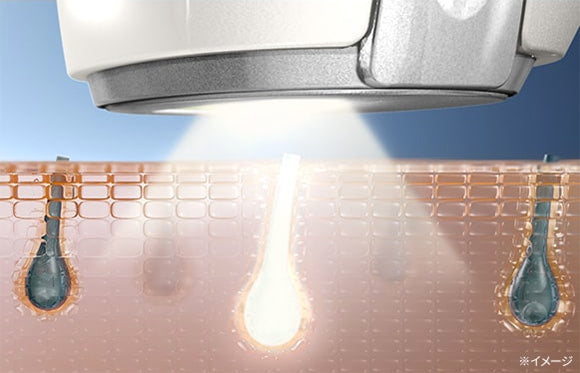 リファビューテック エピ（IPL光美容器）のイメージ画像：黒い色素（メラニン色素）に反応する光を照射し、発生する熱でムダ毛にアプローチ。