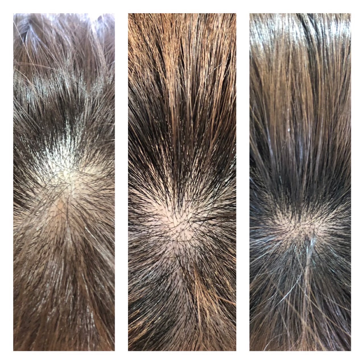 Hairaddict Hair Densifying Serum（ヘアアディクト ヘアデンシファイングセラム）：2週間ごとの経過