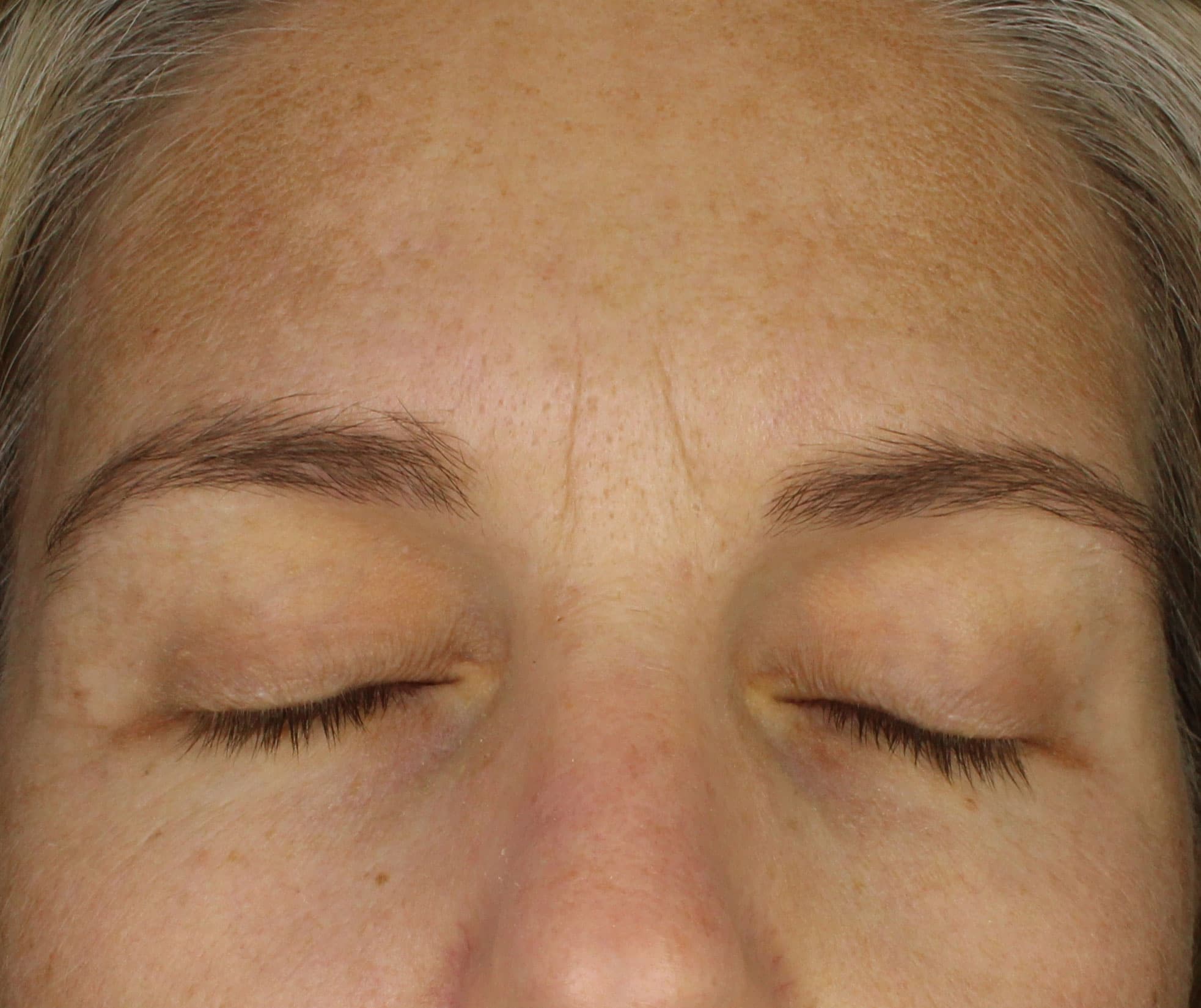 Retinol Skin Booster After