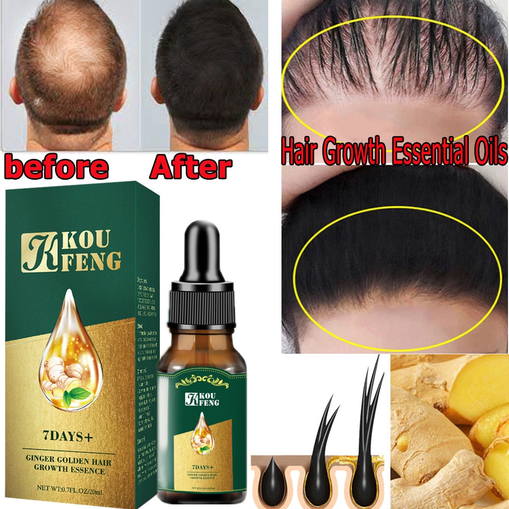 Hair Treatment Ginger Hair Growth Essential Oil Serum Anti Lost Beauty  Products Fast Grow Repair Scalp