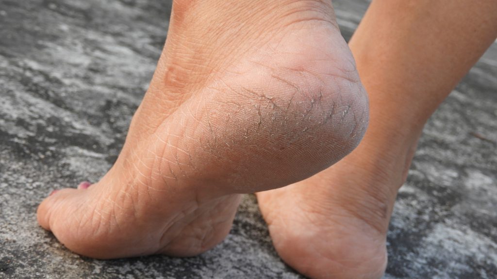 Serum Doctor - Flawless Foot File