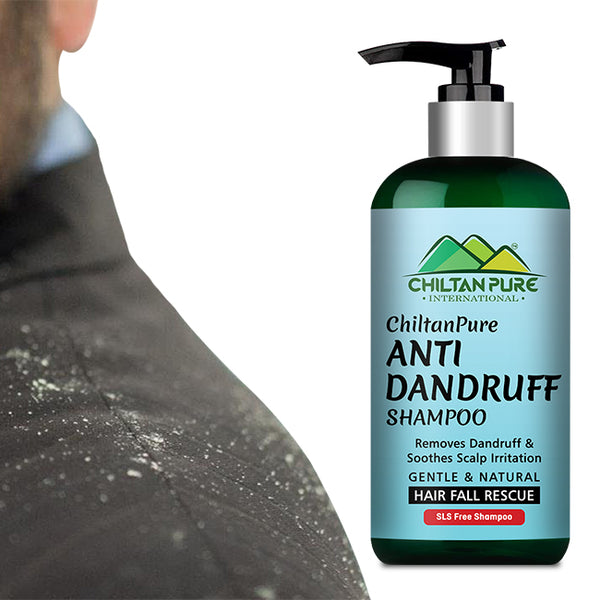 Anti Dandruff Shampoo – Strengthens Hair, Eliminate Wet Dandruff, Soot –  ChiltanPure