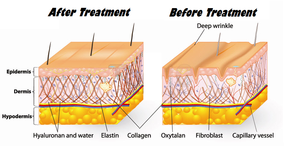 Why Glycolic Acid   U2013 Clinage Skin Rejuvenation System