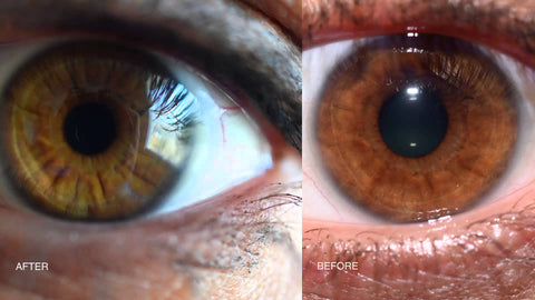 P2 Before and After Iris Colour 