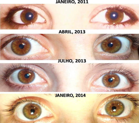 P3 Before After Colour iris 3