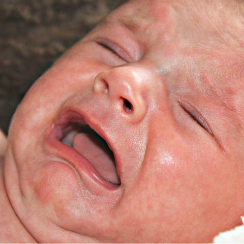 A new born baby crying because of sore nappy rash