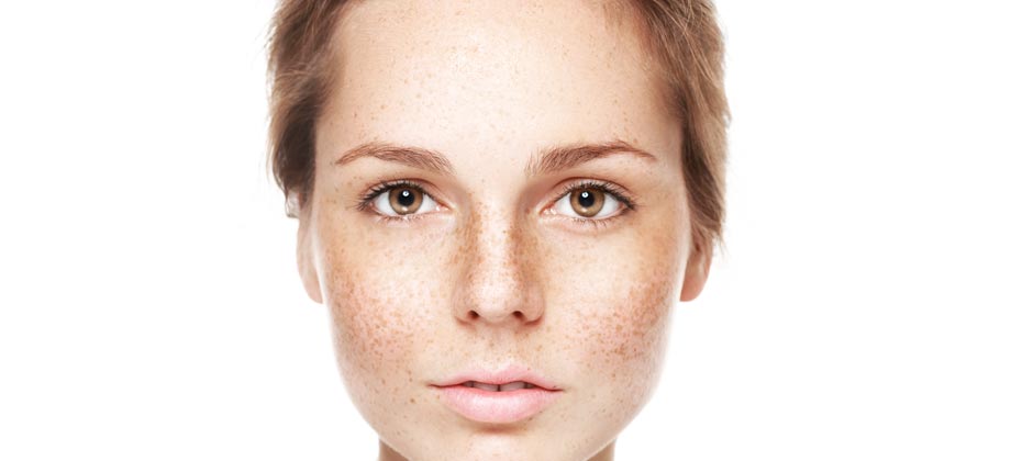 Cope With Pigmentation ~ 為什麼還有這麼多黑斑...？！