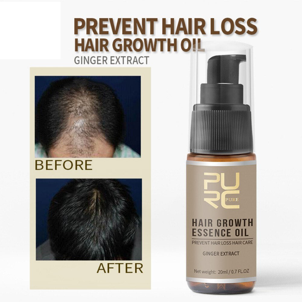 20Ml Fast Hair Growth Essential Oil Effective Hair Loss Treatment Regr –  SavyShop