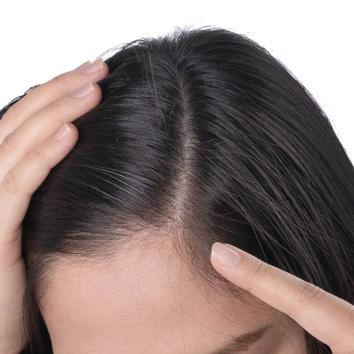 Most Common Causes of Grey Hair & How Can You Reverse It - Bodytales