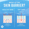 skin barrier