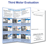 Third Molar Evaluation